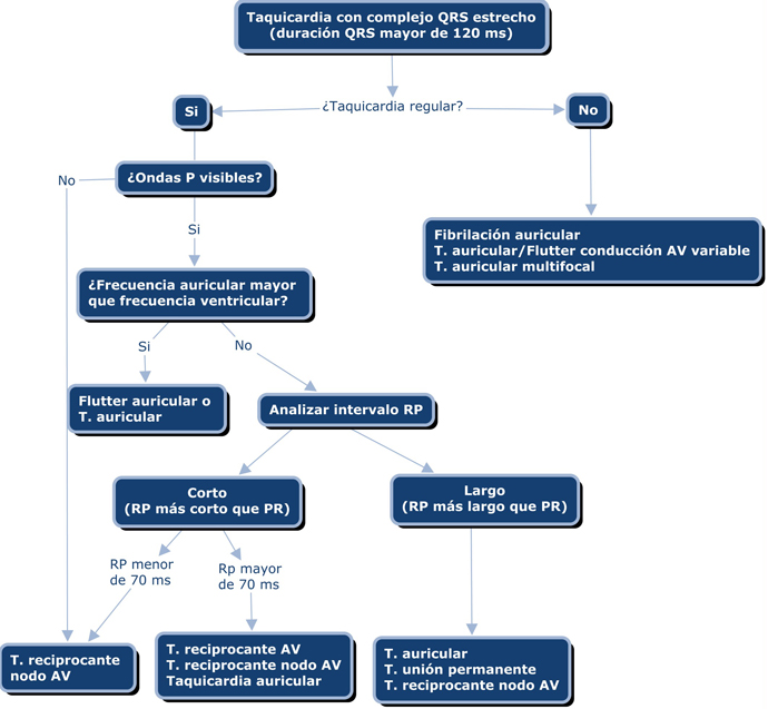 TAQUICARDIA_QRS_ESTRECHO