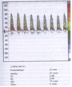 eco_ucip34