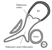 fetal4