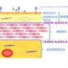 Aterosclerosis