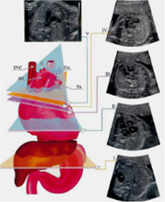 fetal1